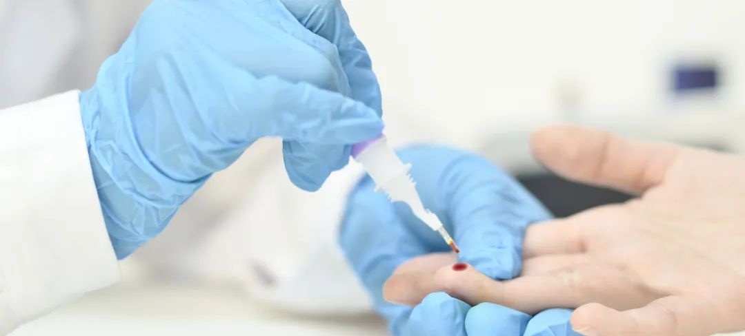 腺苷脫氨酶(ADA)臨床意義解讀