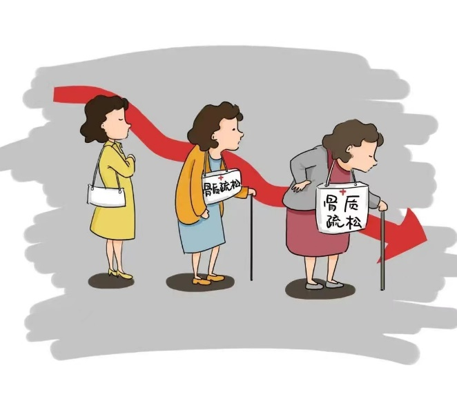 禾柏全血25-羥基維生素D，助力骨骼健康